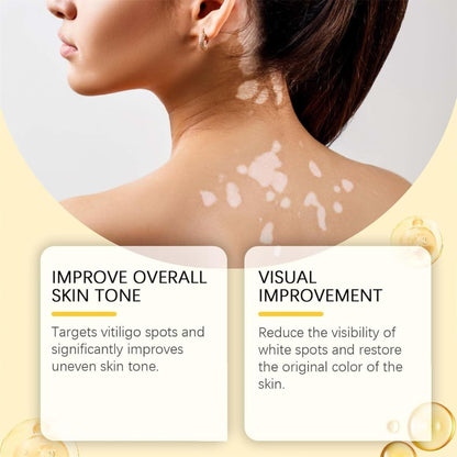 Vitigo Bee Venom Treatment Cream | Natural Skin Repair Hydration Relief Anti-Irritation